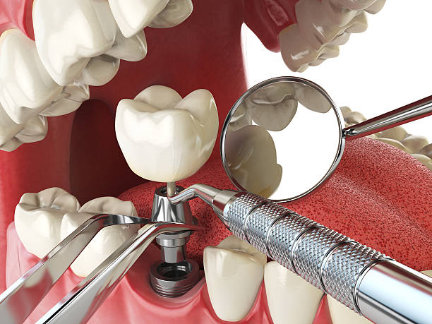 Best Cosmetic Emergency Dentistry in Tanaina, AK